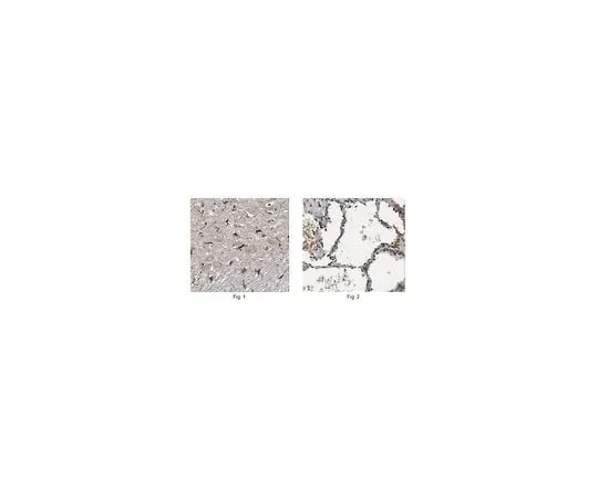 62-8467-06 Anti-ORMDL3 ABN417