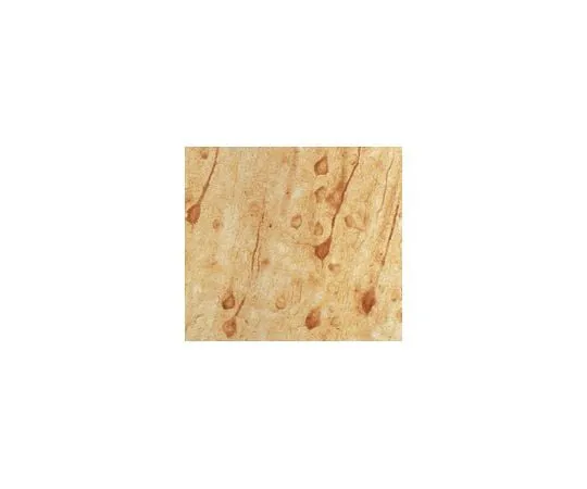 62-8445-22 Anti-NMDAR2AandB, pan; 50 μg AB1548