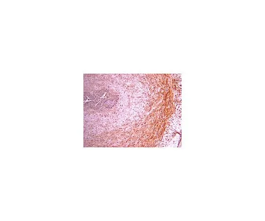 62-8444-53 Anti-Procollagen Type III PIIINP; 100 μg AB764P