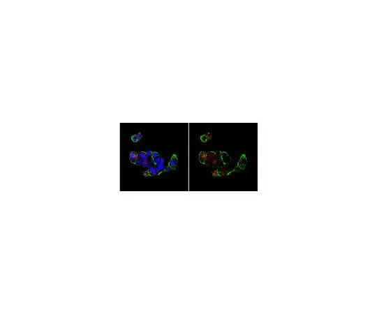 62-8456-31 Anti-Bax (N-terminus); 100 μg ABC11