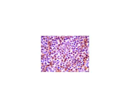 62-8446-64 Anti-LCN2; 100 μg AB2267