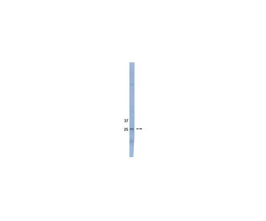 62-8367-83 Anti-SOCS3, clone 1B2; 100 μg 04-004