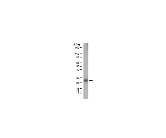 62-8388-58 Anti-Ubiquitin 7-30