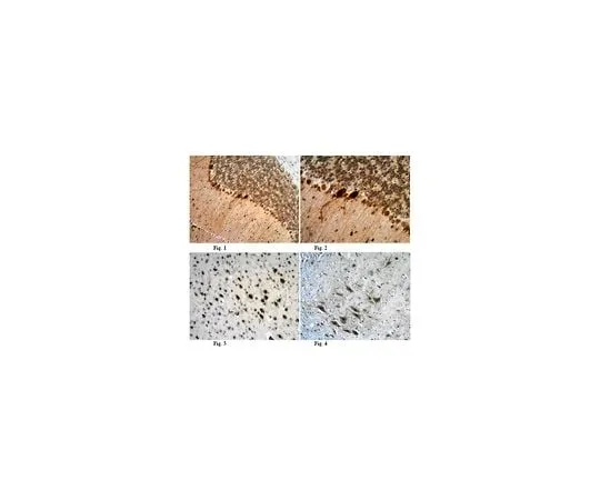 62-8456-34 Anti-Cystatin-C; 100 μg ABC20