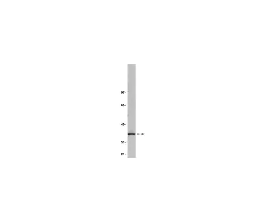 62-8371-68 Anti-PP2A, C subunit, clone 7A6; 200 μL 05-545