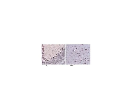 62-8466-52 Anti-LGI1 ABN307