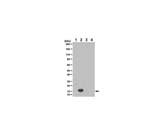 62-8393-26 Anti-Citrulline (Modified) Detection Kit 17-347B