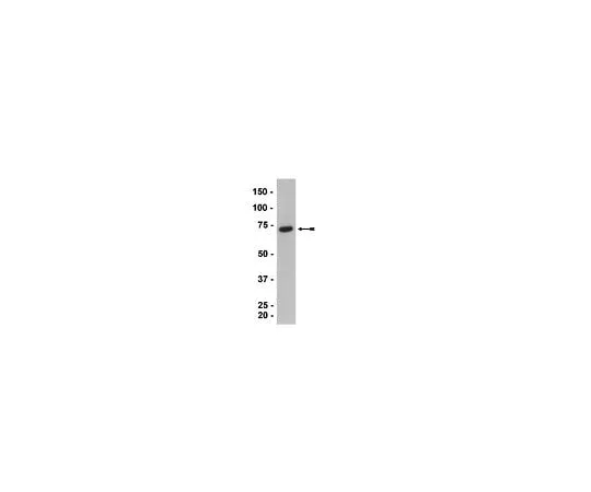62-8386-45 Anti-HRI; 100 μL 07-728
