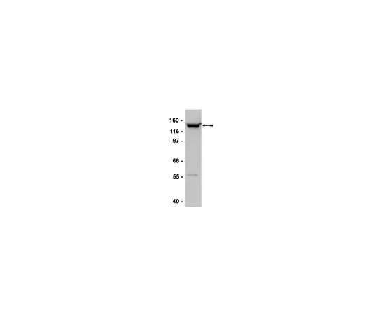 62-8386-36 Anti-SMC2/hCAP-E; 100 μL 07-710