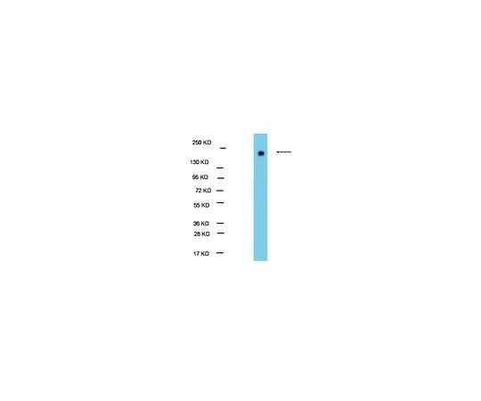62-8389-25 Anti-EHMT1/GLP1; 100 μg 09-078