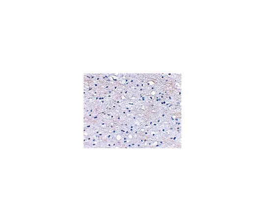 62-8466-78 Anti-BRAL1 ABN349