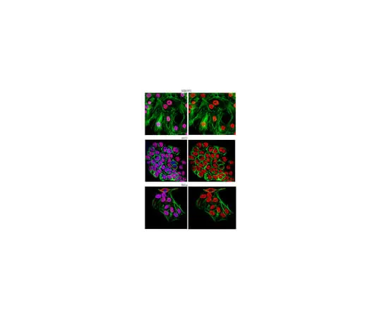62-8375-44 Anti-U1-70K, clone 9C4.1; 100 μg 05-1588