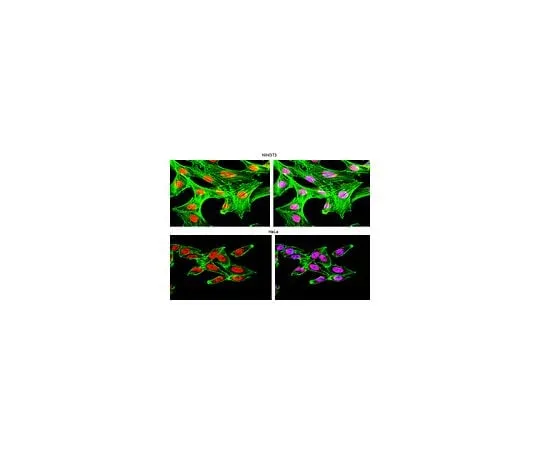 62-8385-29 Anti-HuR; 100 μg 07-468