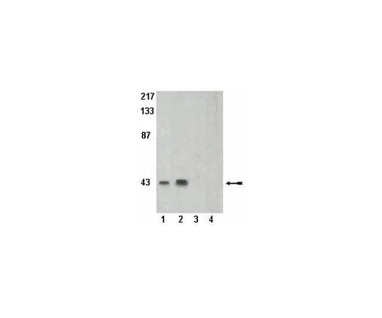 62-8386-93 Anti-phospho-PRAS40 (Thr246) (Proline-Rich AKT substrate); 100 μL 07-888