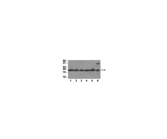 62-8373-75 Anti-Histone H3, CT, pan, clone A3S; 100 μL 05-928