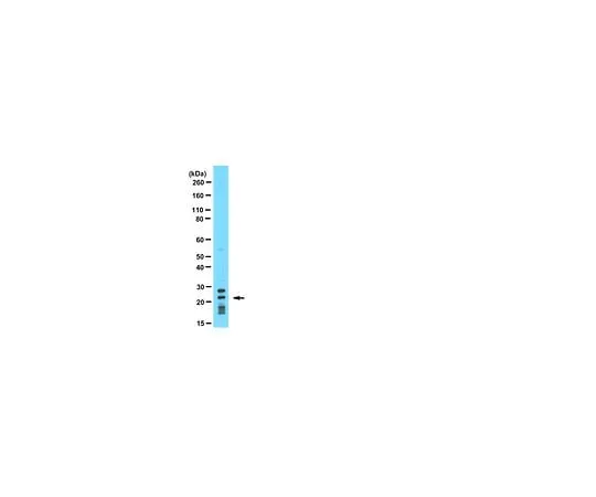 62-8454-35 Anti-Puma BH3 domain; 100 μg AB10418