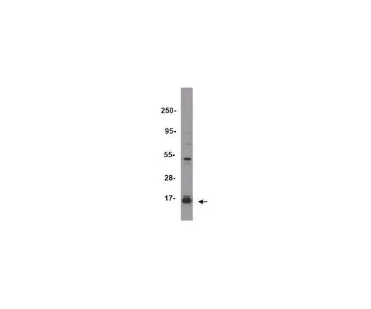 62-8393-61 ChIPAb+ Trimethyl-Histone H3 (Lys27); 25 assays 17-622