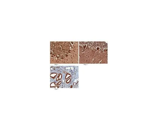 62-8456-68 Anti-Praf2 (JM4) ABC95
