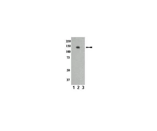 62-8386-96 anti-phospho-Pyk2/CAKβ/FAK2 (Tyr402); 100 μL 07-892