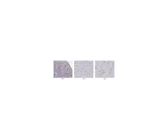 62-8466-19 Anti-IL-12 alpha Antibody, Cat. No. ABN213 ABN213