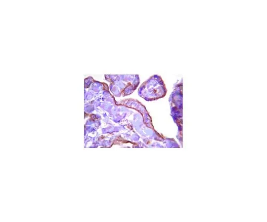 62-8387-86 Anti-Calcineurin Aβ; 100 μL 07-1493
