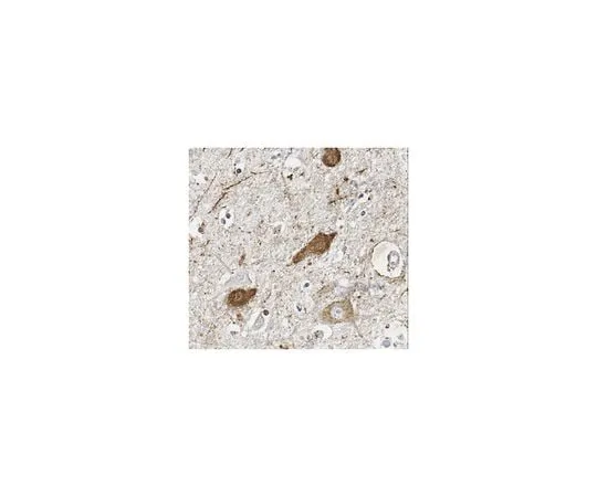62-8467-97 Anti-MAGL ABN1000