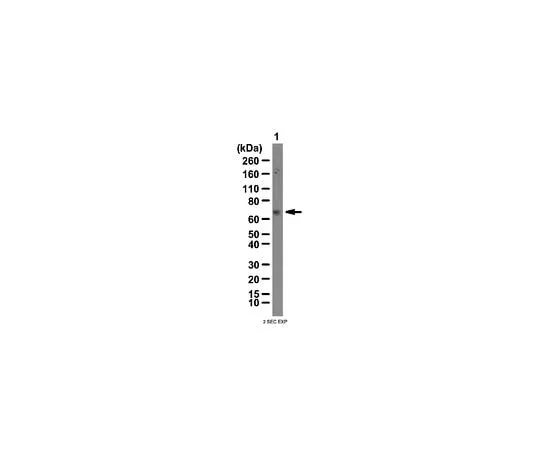 62-8383-72 Anti-IGF2 mRNA-binding protein 3; 100 μg 07-104