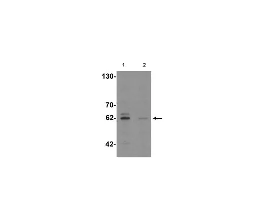 62-8467-52 Anti-KCNK13 ABN484