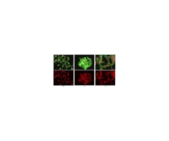 62-8461-45 Anti-UTX ABE409