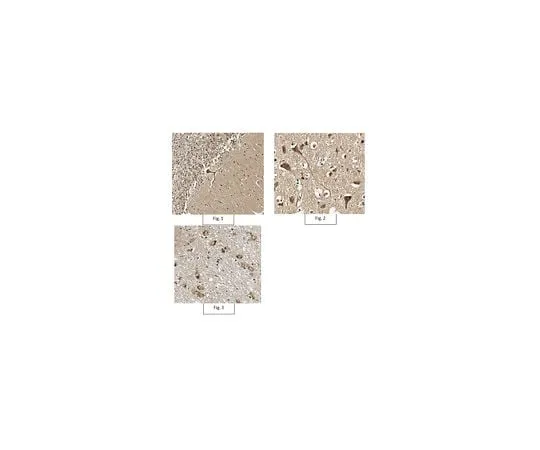 62-8467-96 Anti-phospho PSD95 Antibody (Thr19) ABN998