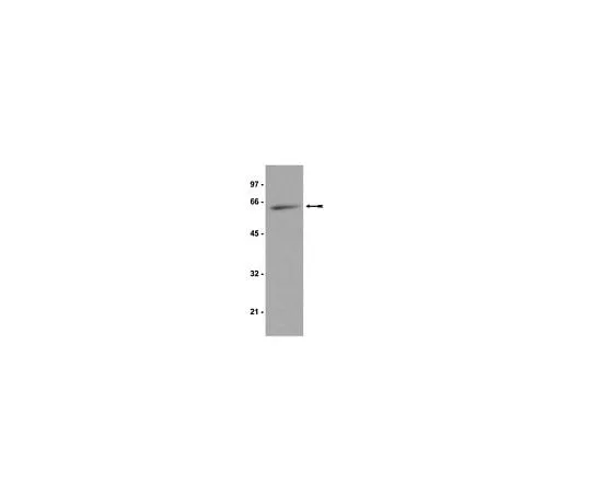62-8384-83 Anti-p70 S6 Kinase; 200 μg 07-402