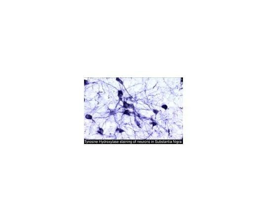 62-8452-15 Anti-Tyrosine Hydroxylase; 50 μL AB5986