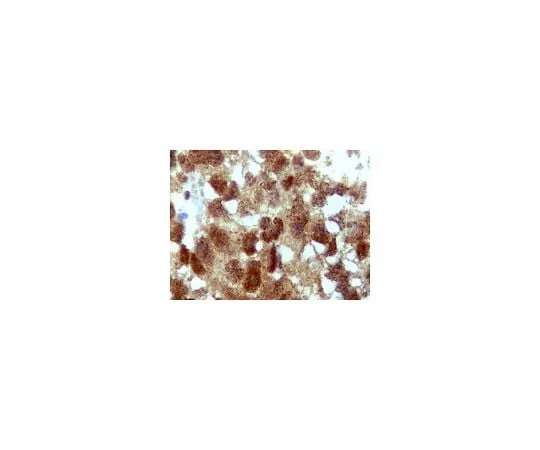 62-8456-35 Anti-Atg4D; 100 μg ABC22