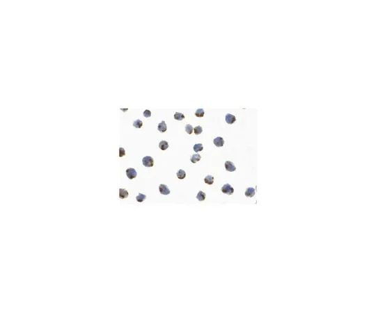62-8467-32 Anti-IRE1p ABN464