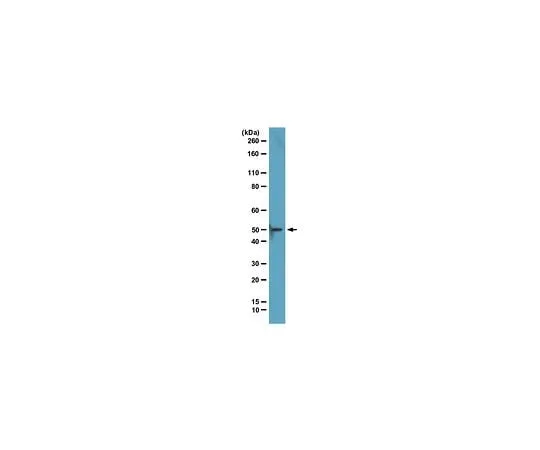 62-8393-75 ChIPAb+ EED; 25 assays 17-663