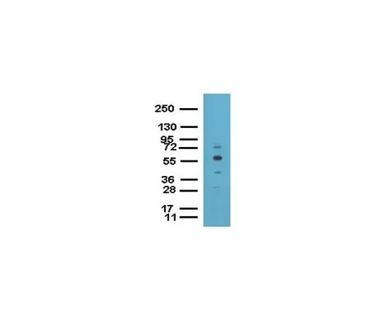 62-8393-95 ChIPAb+ EED; 25 assays 17-10034