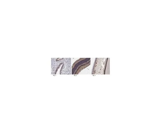 62-8466-17 Anti-TTC8 Antibody Cat. No. ABN209 ABN209