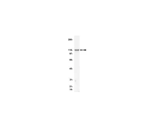 62-8370-99 Anti-Vinculin, clone V284; 200 μg 05-386