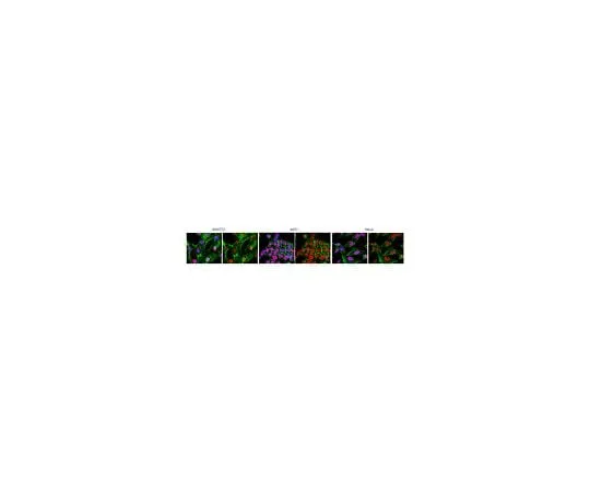62-8460-69 Anti-Histone Macro H2A.1; 100 μg ABE215