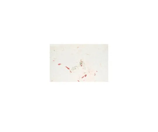 62-8374-90 Anti-Endoglin, clone P3D1; 100 μg 05-1424
