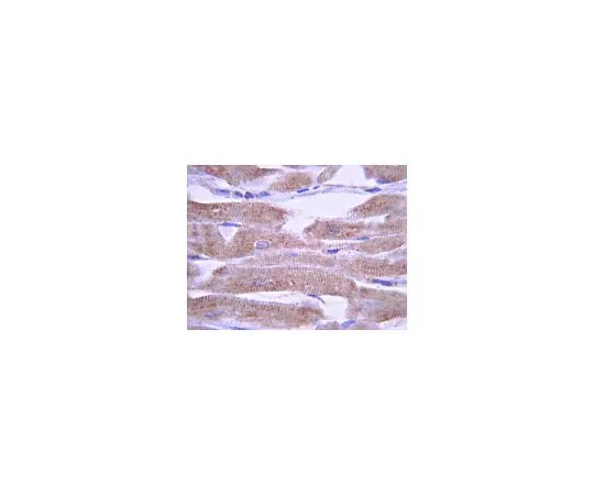 62-8451-98 Anti-Potassium Channel KvLQT1, C-terminus; 100 μg AB5932