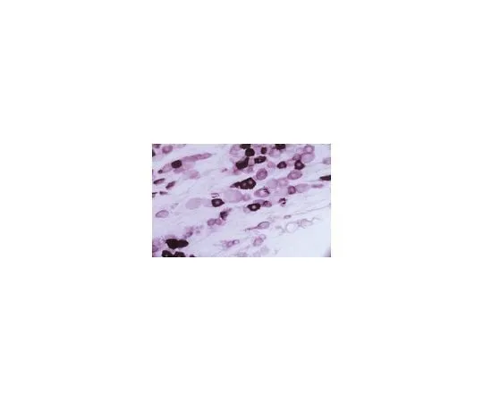 62-8449-93 Anti-Vanilloid Receptor Like Protein, pain, C-terminus; 20 μg AB5398P