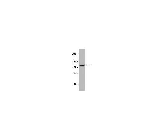 62-8385-86 Anti-GluR2/3; 200 μg 07-598