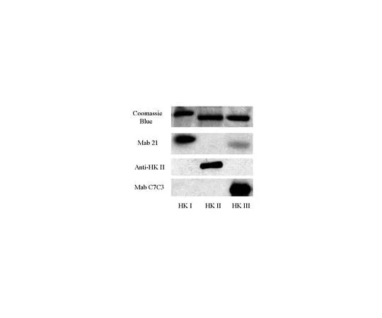 62-8447-66 Anti-Hexokinase Type II; 100 μL AB3279