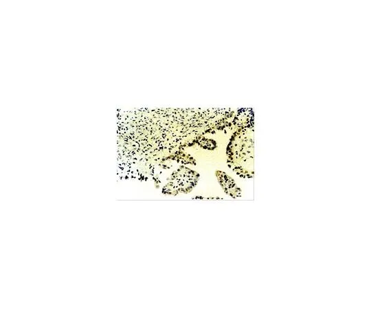62-8452-52 Anti-p73, alpha and beta; 100 μg AB7824