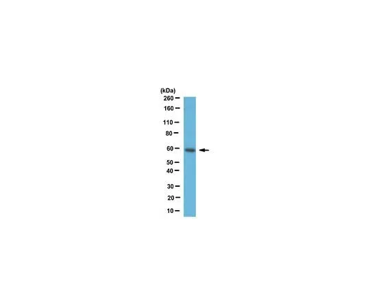 62-8458-16 Anti-PKM2 ABC438