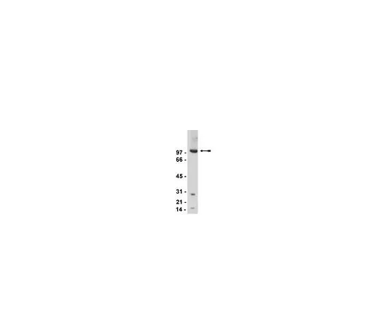 62-8381-87 Anti-mGluR2/3; 200 μg 06-676