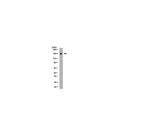 62-8446-71 Anti-Na+K+Cl- Cotransporter 2; 100 μg AB2281