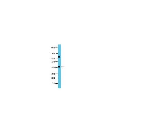 62-8387-22 Anti-PP2A-B’ (B56); 100 μg 07-1221