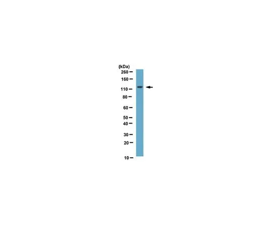 62-8461-82 Anti-hRNF20 Antibody, Cat. No. ABE473 ABE473